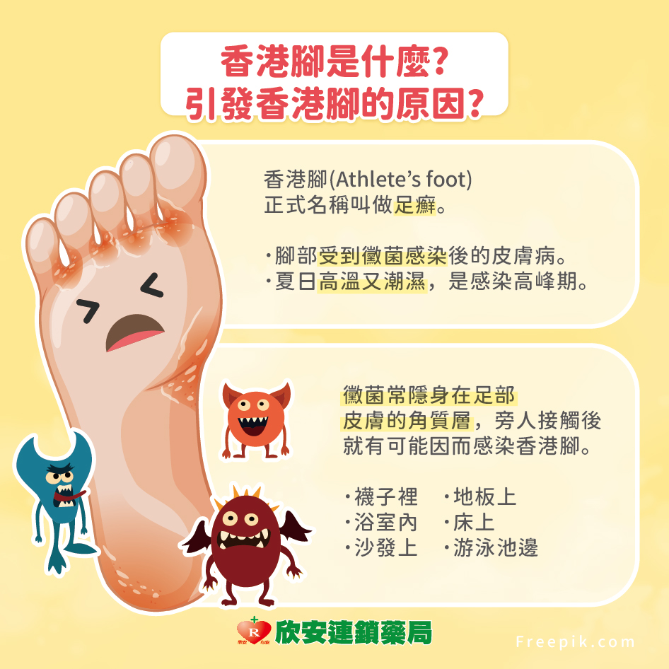 香港腳好難好?專家教你掌握這幾招，治療香港腳更有效!