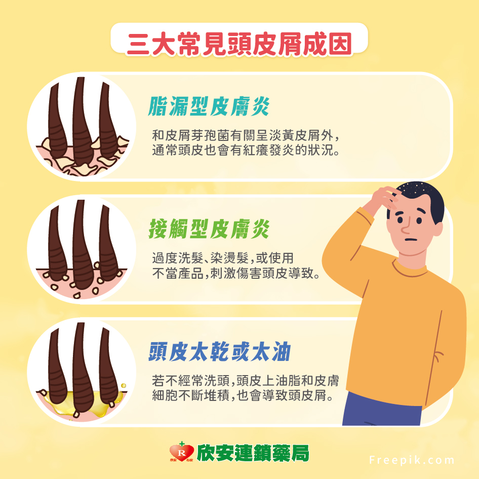 頭皮屑總是令人尷尬？專家公開頭皮屑原因與改善方式，幫助你徹底甩掉頭皮困擾