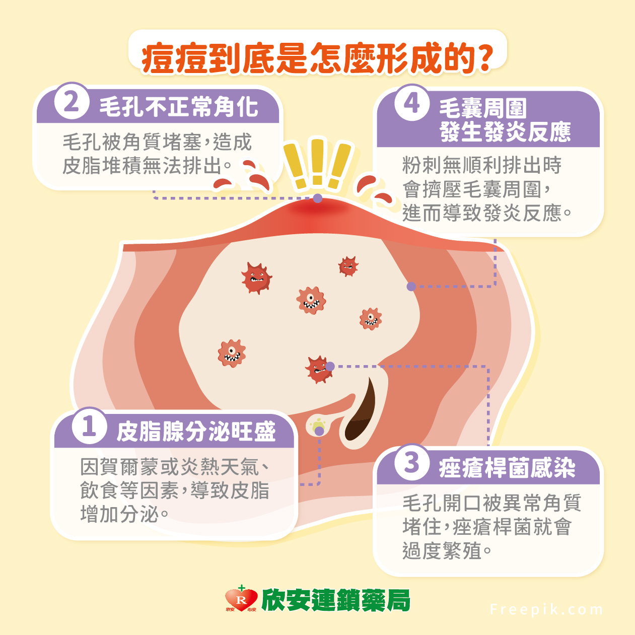 為什麼痘痘一直長?3分鐘搞懂冒痘原因，快速擺除面子問題!