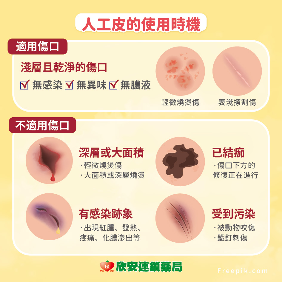proimages/shinanhealth/20251030人工皮/你真的會用人工皮嗎3.jpg proimages/shinanhealth/20251030人工皮/你真的會用人工皮嗎3.jpg