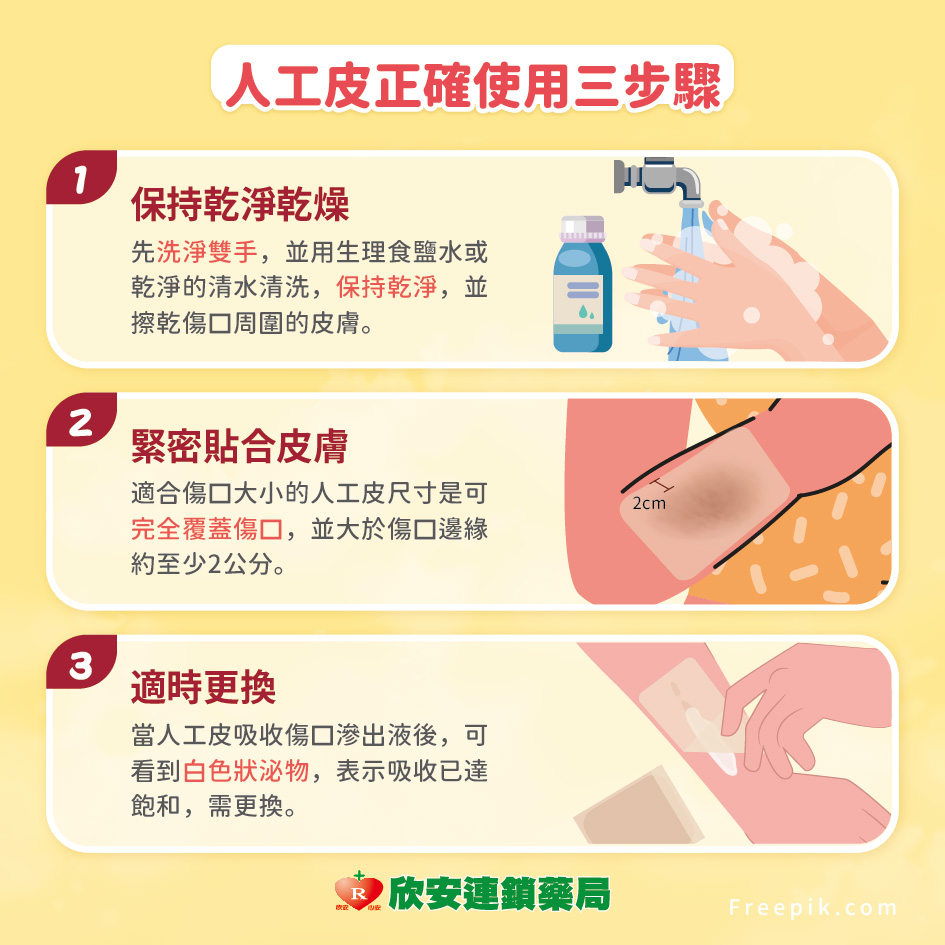 proimages/shinanhealth/20251030人工皮/你真的會用人工皮嗎4.jpg proimages/shinanhealth/20251030人工皮/你真的會用人工皮嗎4.jpg