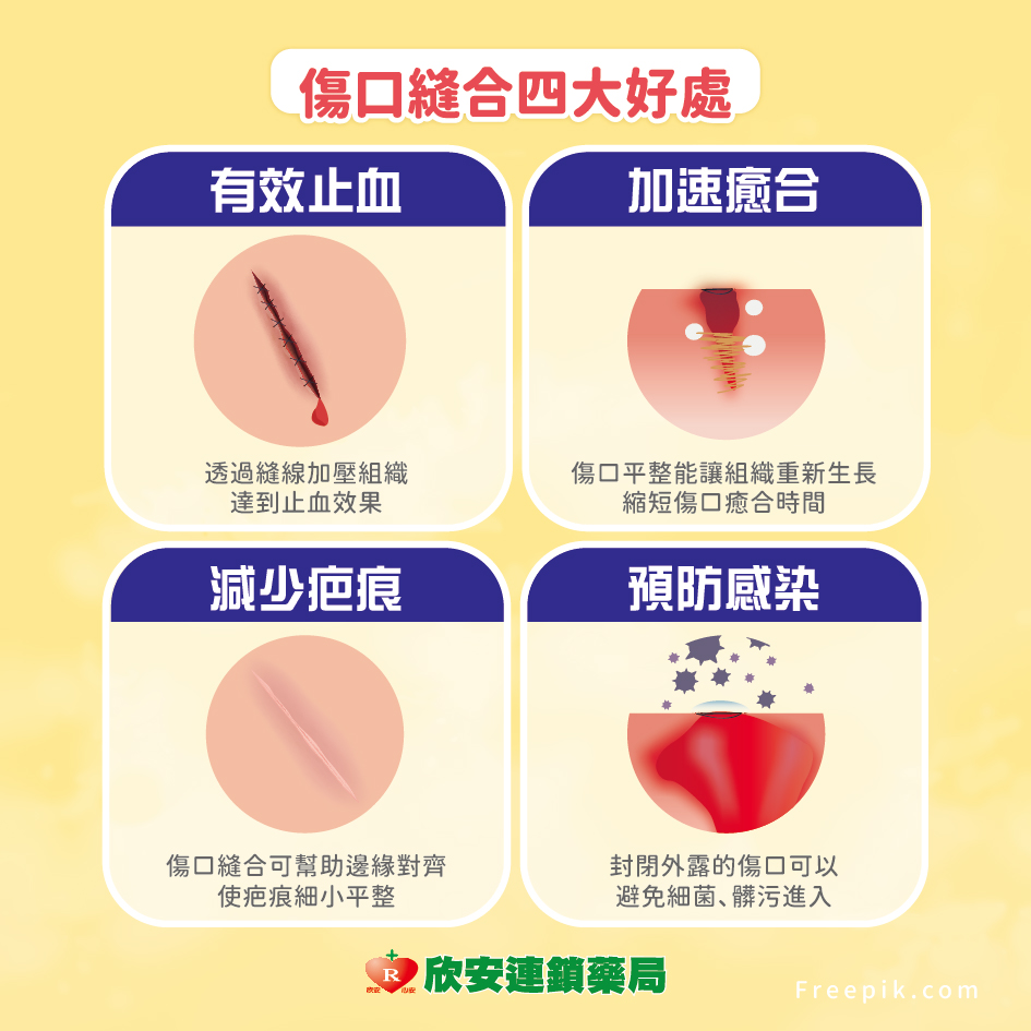 proimages/shinanhealth/20260512術後拆線除疤/術後拆線除疤-2.jpg proimages/shinanhealth/20260512術後拆線除疤/術後拆線除疤-2.jpg