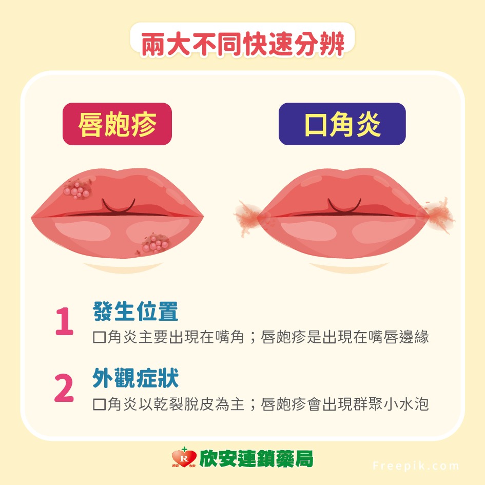 proimages/shinanhealth/20260812純皰疹口角炎/純皰疹-3.jpg proimages/shinanhealth/20260812純皰疹口角炎/純皰疹-3.jpg