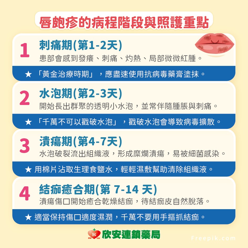 proimages/shinanhealth/20260812純皰疹口角炎/純皰疹-4.jpg proimages/shinanhealth/20260812純皰疹口角炎/純皰疹-4.jpg
